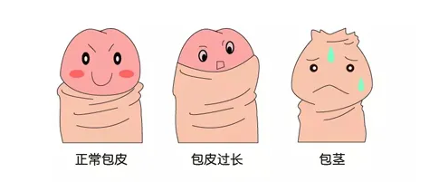 1-211126162349510.png